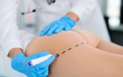 Tratamento Metabólico de Complicações Pós Preenchimento Corporal
