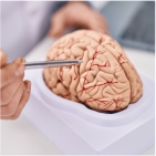 Neurologia