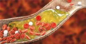 Lipidograma com LDL destacado — colesterol e risco cardiovascular além do número