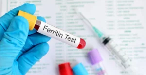 Ferritina alta no exame — inflamação e metabolismo além do estoque de ferro